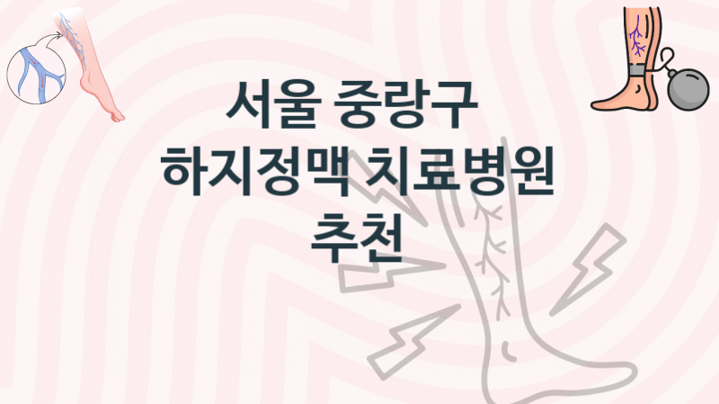 서울 중랑구 하지정맥, 병원, 예방 치료비용 추천