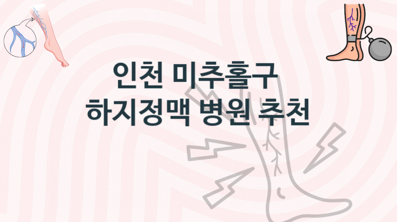 인천 미추홀구 하지정맥, 치료병원, 예방 치료비용