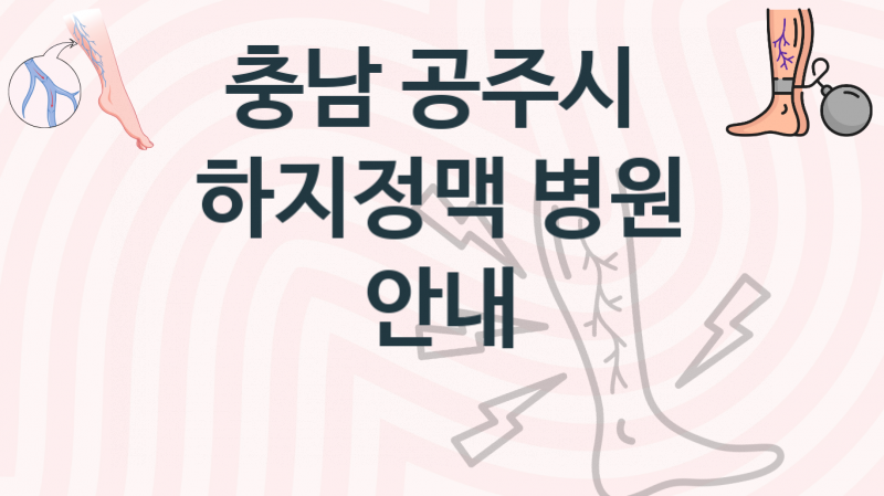 충남 공주시 추천하는 하지정맥 병원